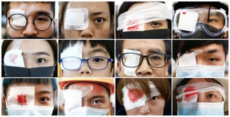 Hong Kong, violences policières, hopital, médecins,