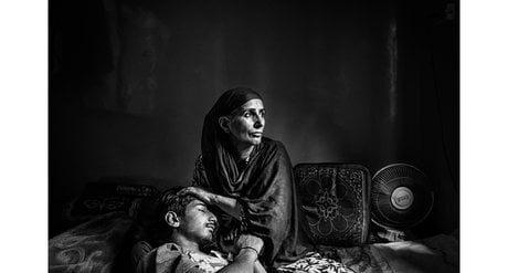 Farzan Sheikh, alors âgé de 16 ans, a été blessé à l’œil gauche par un policier indien armé d’un fusil à plomb le 28 mars 2017 dans son quartier de Srinagar, dans la partie du Cachemire administrée par l’Inde. Farzan a de nouveau été victime de tirs de plombs en août qui l’ont rendu aveugle de l’œil droit.