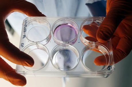 Un prix d'inventeur europeen 2019 pour un chercheur de l'inserm