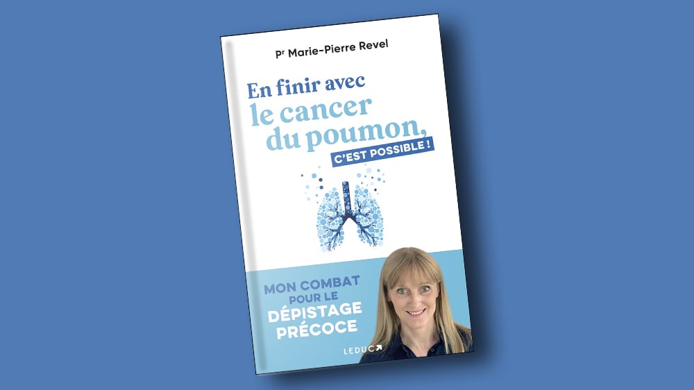 Marie-Pierre Revel, professeure en radiologie à l’Université Paris-Cité, et autrice du livre « En finir avec le cancer du poumon, c’est possible ! ».