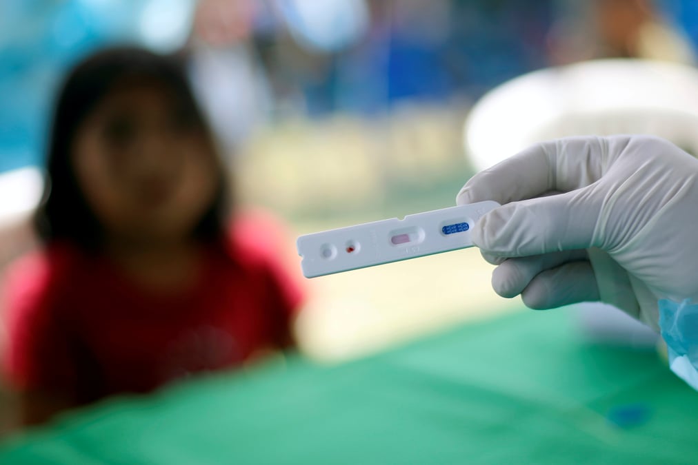 Coronavirus: plus de 1,4 million de cas confirmes au bresil