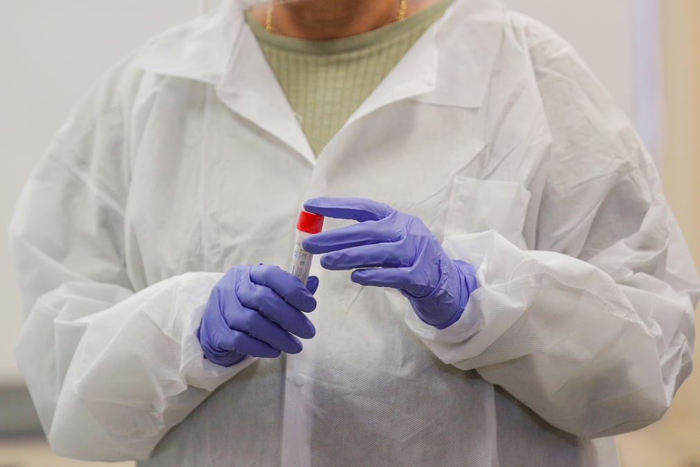 Coronavirus: biomerieux espere lancer prochainement deux tests serologiques