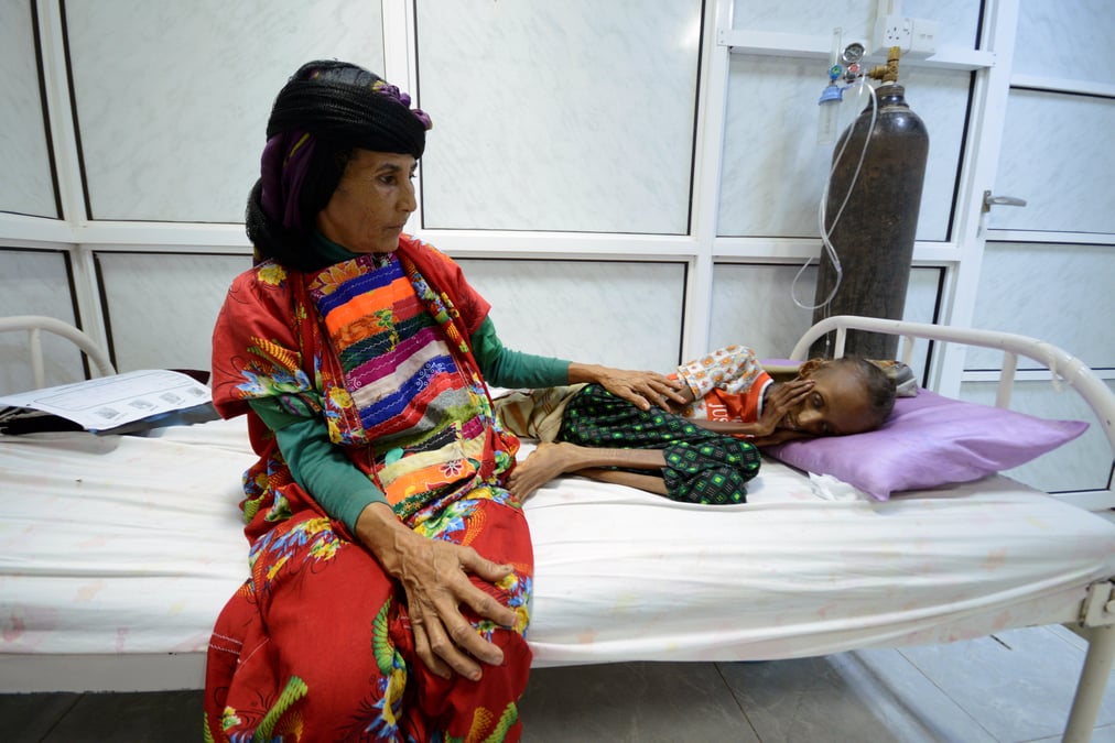 Au yemen, environ 1,5 million d'enfants souffrent de la faim