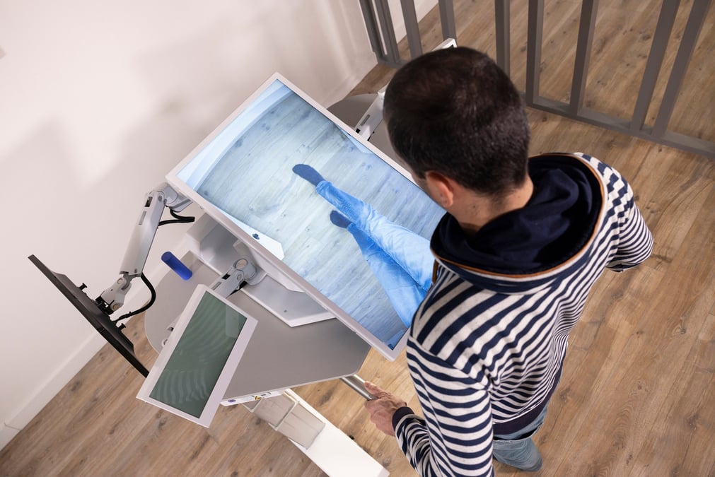 Dispositif développé par Dessintey pour faciliter la récupération des patients amputés ou ayant subi un AVC.