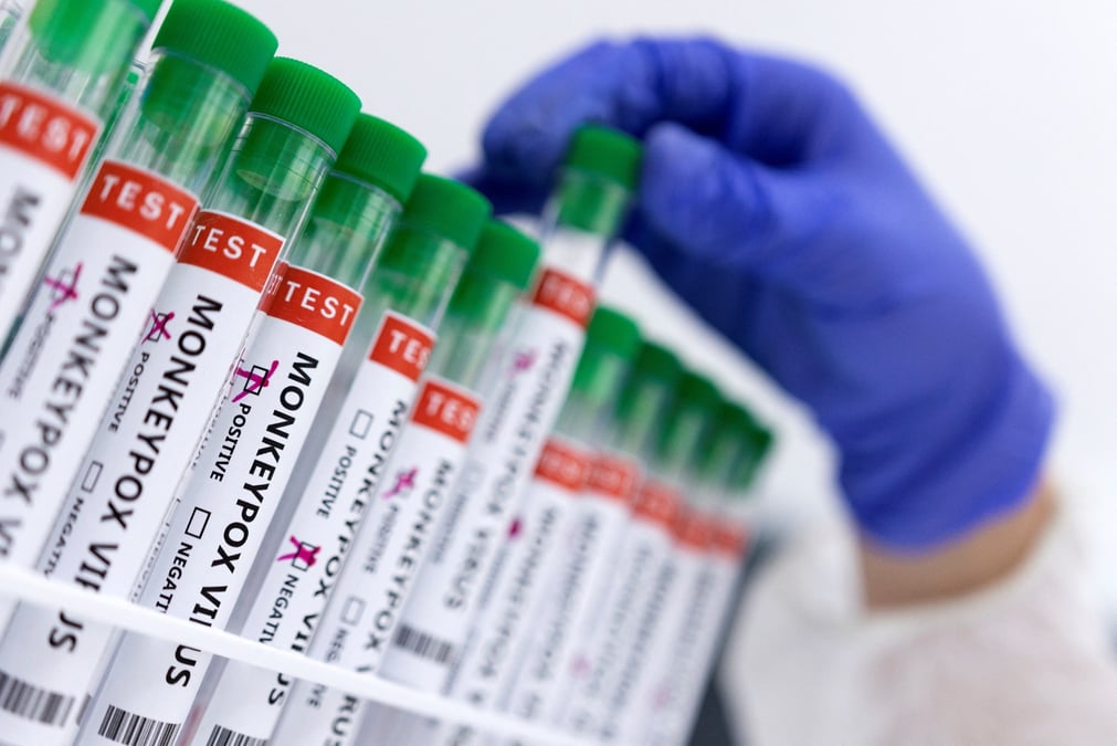 France: la has recommande de vacciner les cas contacts contre la variole du singe