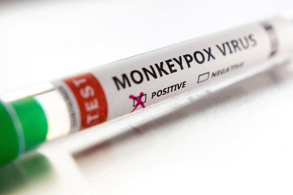 La variole du singe peut etre maitrisee par des actions rapides, dit l'oms