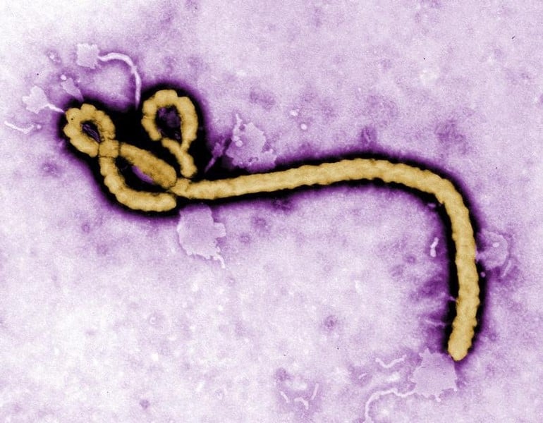 Un cas de fievre ebola diagnostique en ecosse