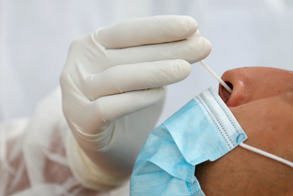 Novacyt lance un test pour differencier la grippe du covid-19, l'action grimpe