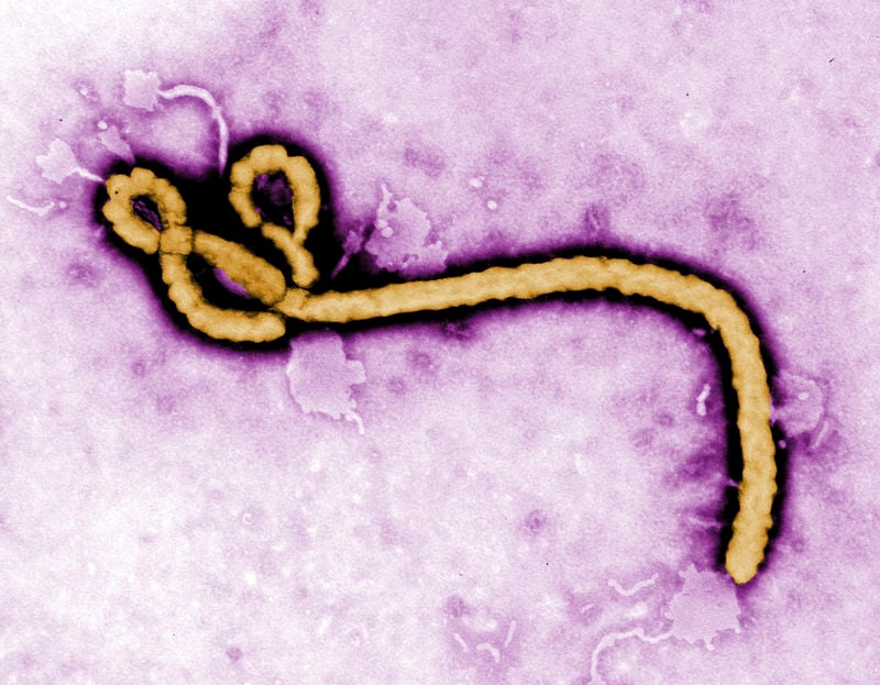 Ebola:la Guinée ferme sa frontière avec le Liberia et la Sierra Leone