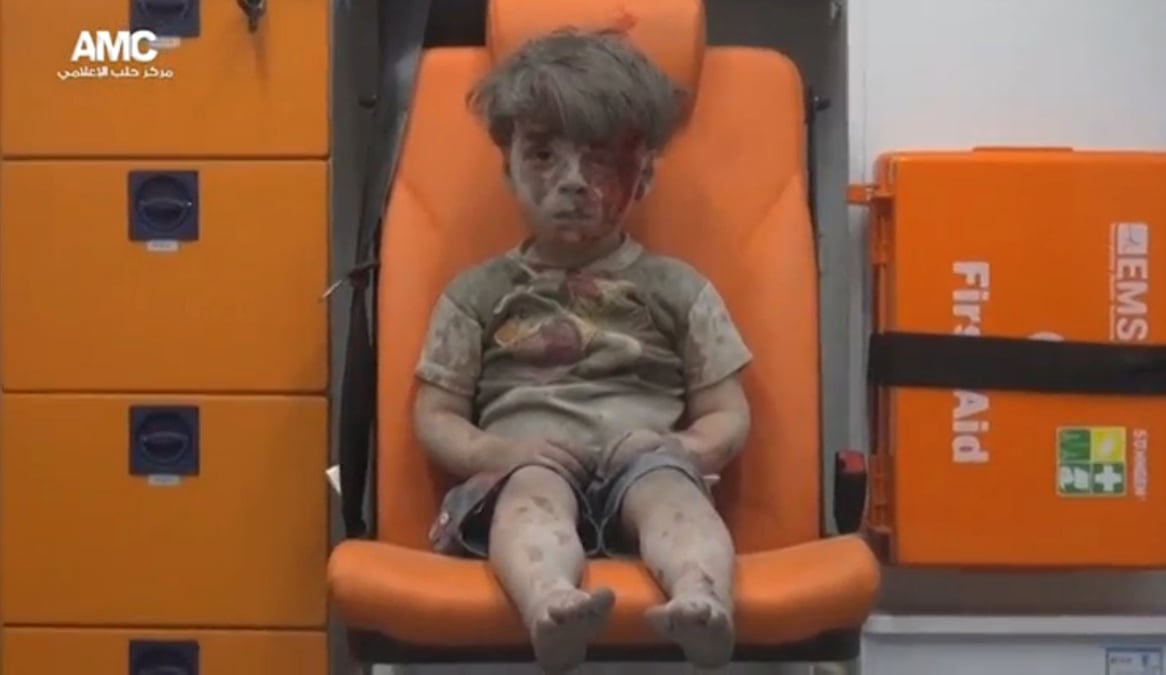 Le "vrai visage" de la guerre en syrie