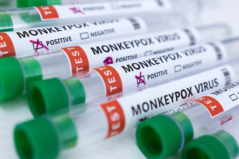 Selon l'oms, il est peu probable que la variole du singe debouche sur une pandemie