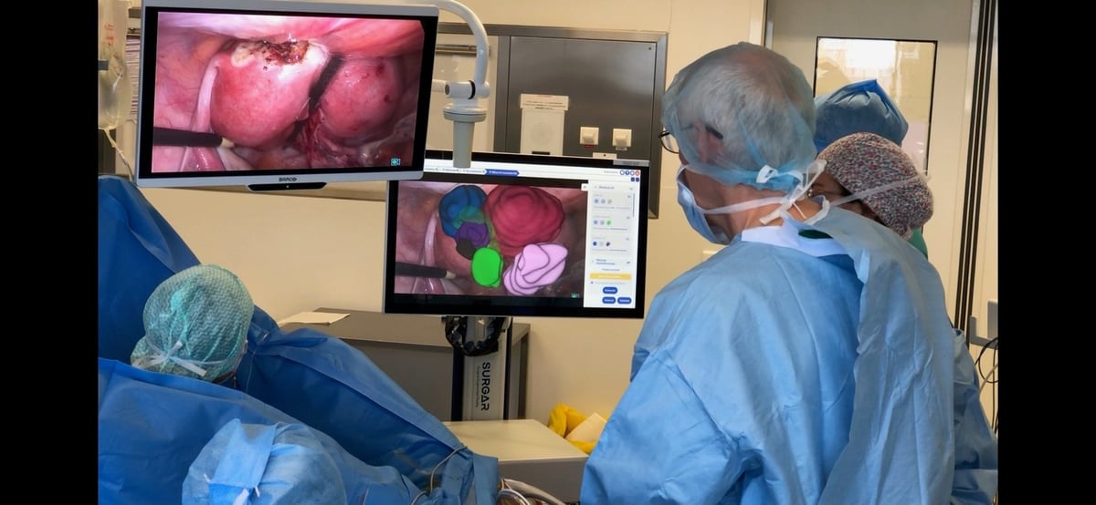 D'ici 2030, Surgar vise 100.000 patients opérés avec son dispositif, afin d'augmenter le nombre de chirurgies mini-invasives réalisées sur trois organes ciblés : l'utérus, le foie et le rein.