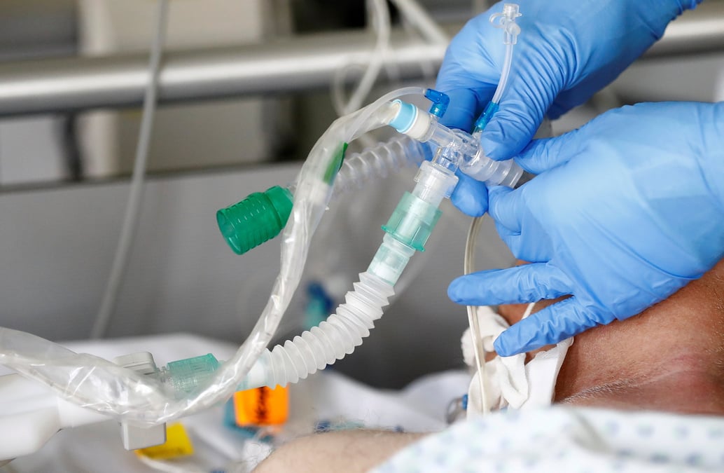 Une unite de soins intensifs a darmstadt