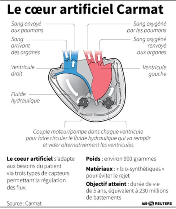 Le patient au coeur artificiel va bien