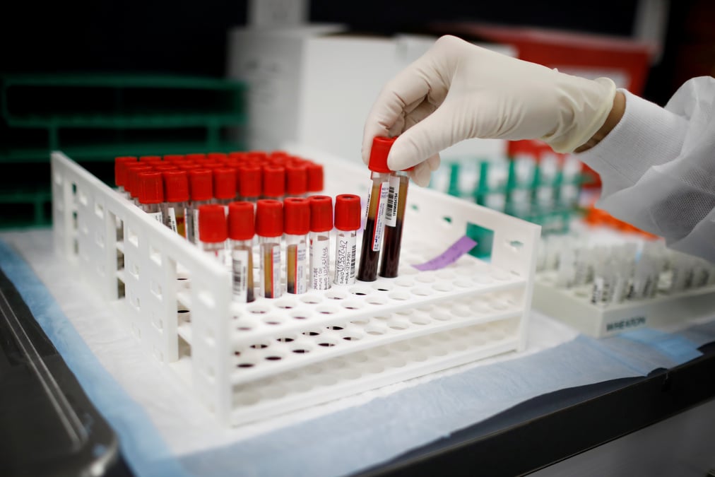 Berlin table sur des premiers vaccins anti-covid en europe debut 2021