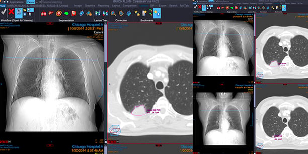 Imagerie Carestream