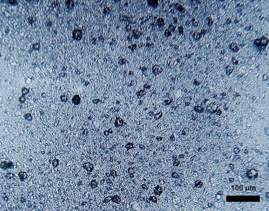 Minuscules polymères synthétiques et non biodégradables, les microplastiques s'accumulent dans les sols et dans les eaux, de surface (et donc les océans) ainsi que les eaux souterraines. Même si leur impact sur la santé humaine n'a pas encore été clairement établi, ils sont désormais entrés dans la chaîne alimentaire et affectent certains animaux. (Photo : petits morceaux de polyéthylène trouvés dans une pâte dentifrice.)