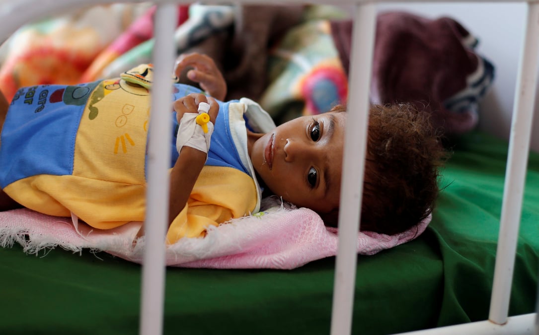 La famine a peut-etre tue 85.000 enfants au yemen, selon un rapport de l'ong