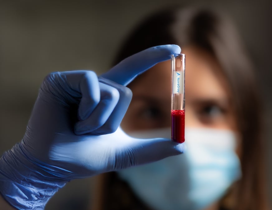 « Plus de 400 patients ont déjà bénéficié du test depuis mars 2025 »
