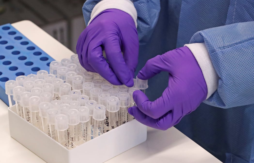 Coronavirus: un premier cas de contamination signale au danemark