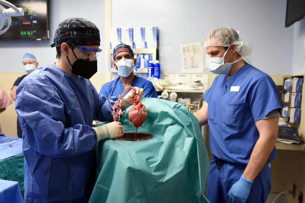 Etats-unis: un homme recoit une greffe de coeur porcin genetiquement modifie