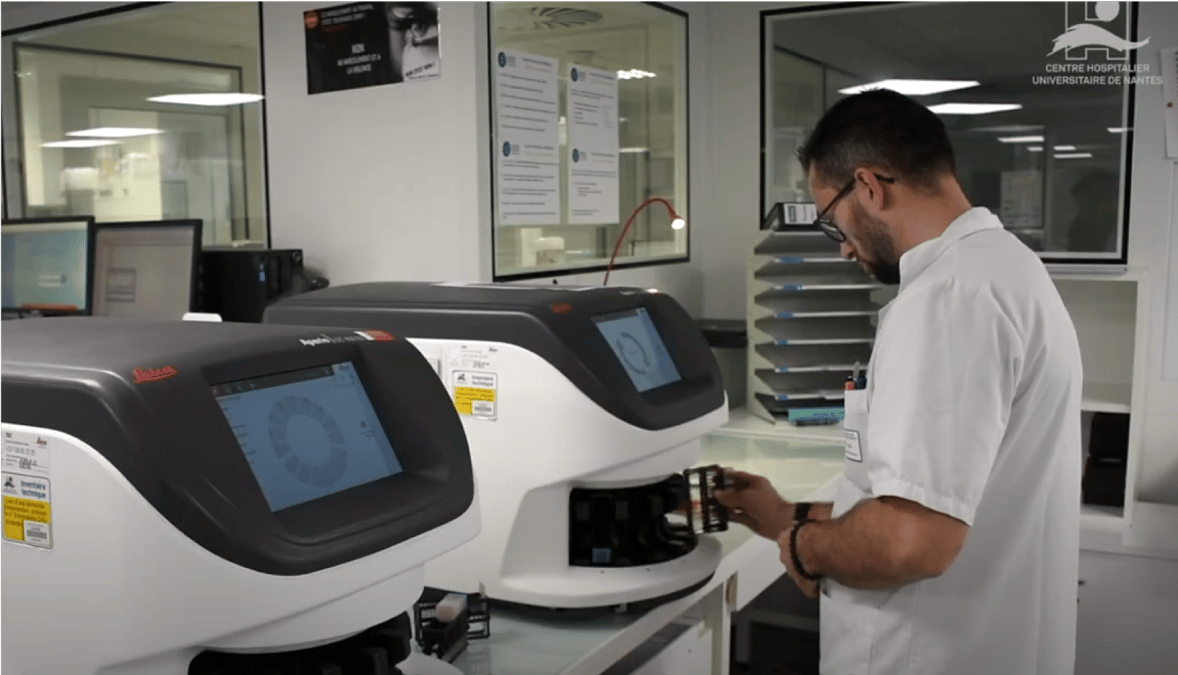 Le CHU de Nantes va utiliser l'IA pour améliorer la prise en charge des cancers.