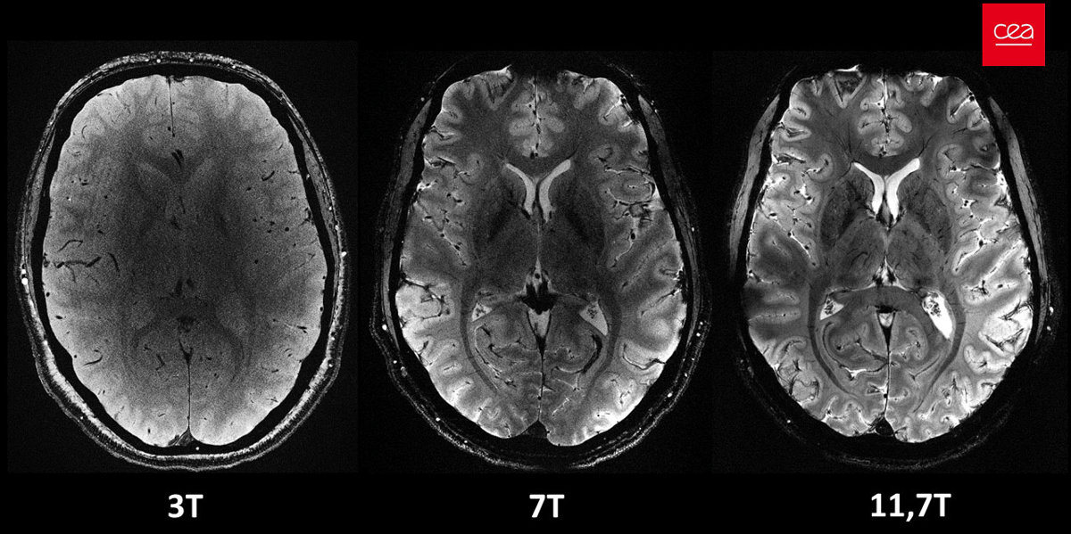 Coupes axiales de cerveau humain, à temps d'acquisition identique mais avec une intensité différente du champ magnétique (*)
