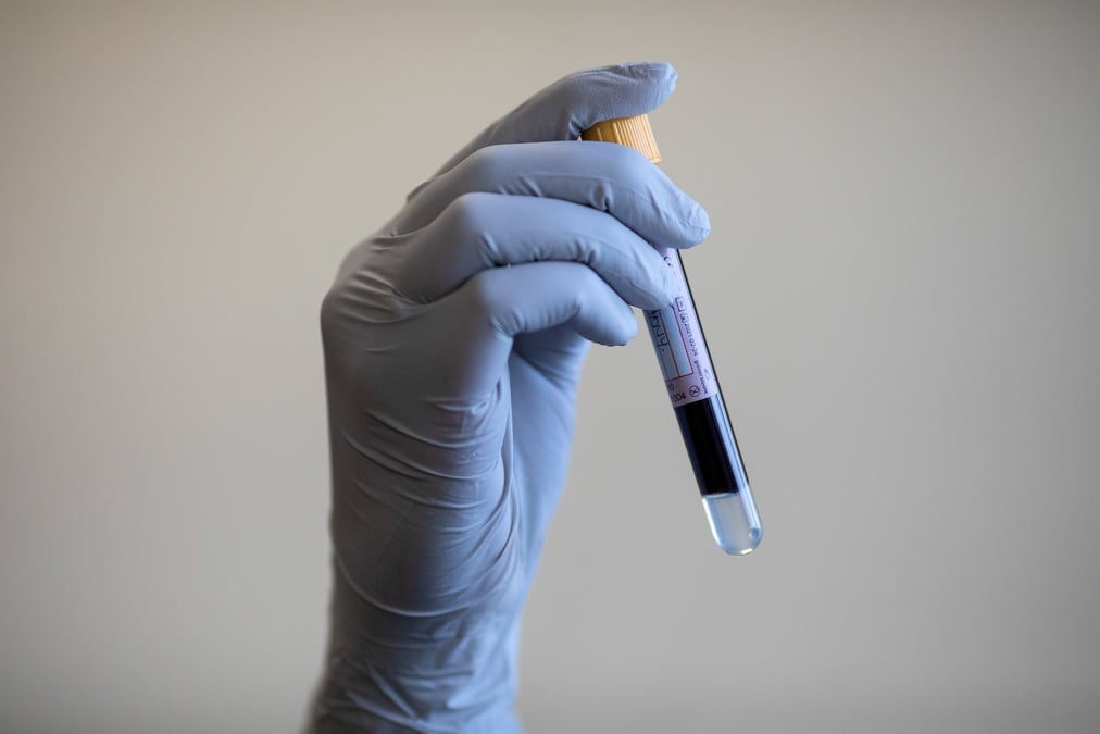 Coronavirus: le royaume-uni recense 713 nouveaux cas de contamination