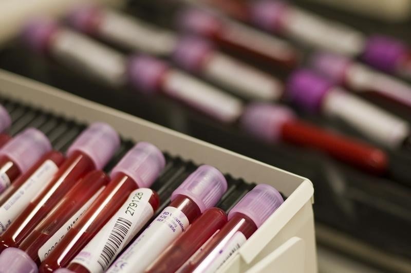 Espoir d'un test sanguin de dépistage précoce d'Alzheimer