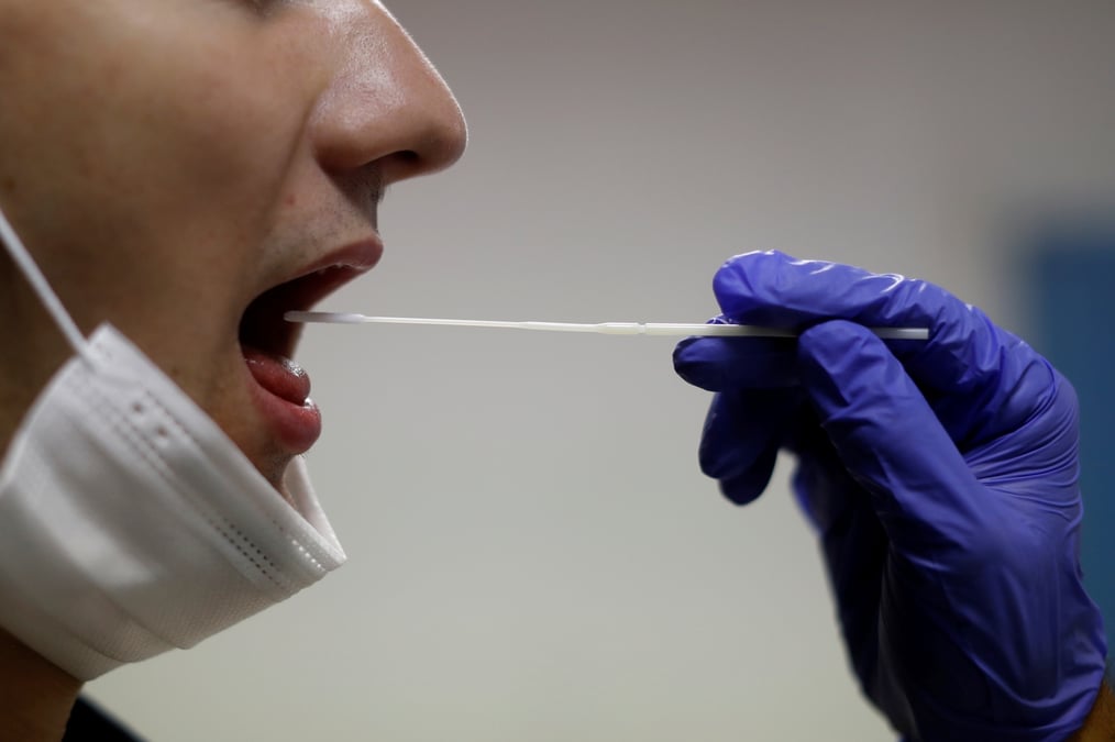 Coronavirus: l'oms promet 120 millions de tests a 5 dollars pour les pays pauvres