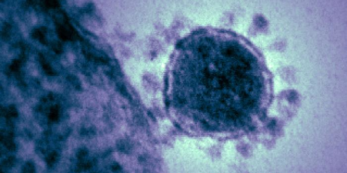 La protéine S des coronavirus leur donne leur aspect si particulier en microscopie (ici le MERS-CoV).  National Institute of Allergy and Infectious Diseases (NIAID)