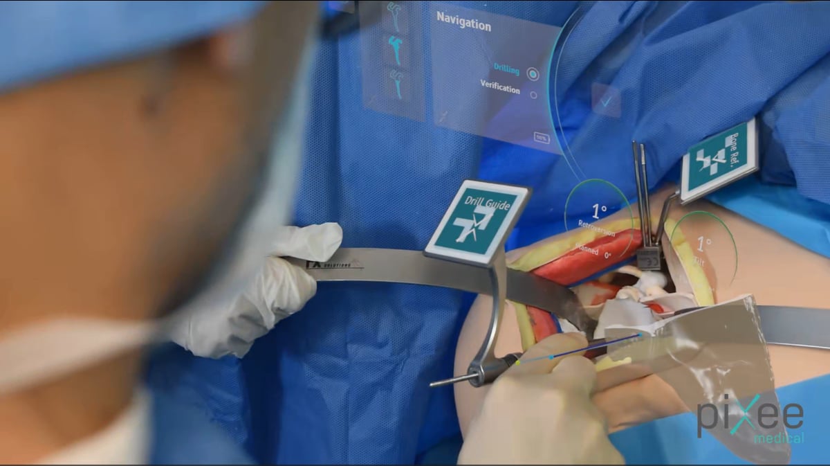 Première mondiale à Strasbourg, à la clinique de l'Orangerie, en août 2023, pour une intervention sur l'épaule, avec la technologie Pixee Medical.