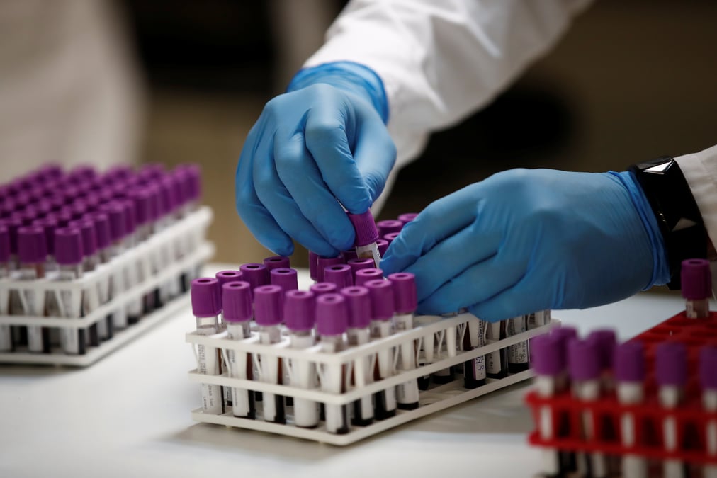 Le coronavirus a fait 28.367 morts (+35)