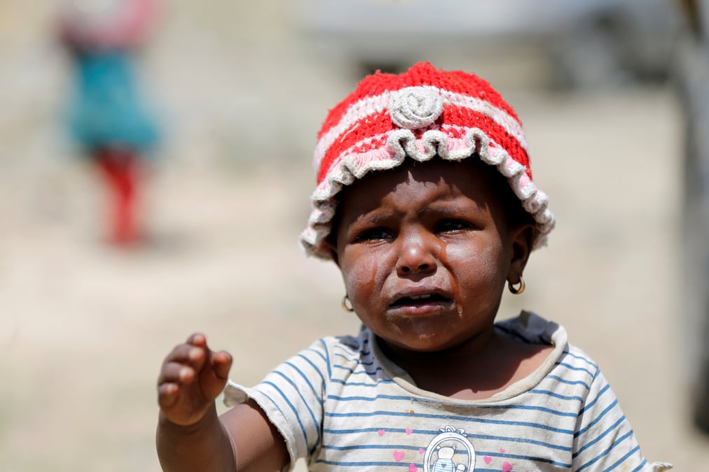 Yemen: de plus en plus d'enfants risquent la malnutrition selon l'unicef