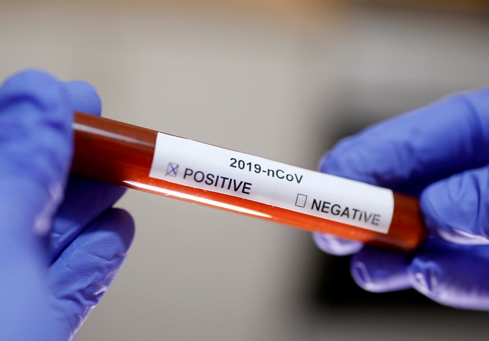 Biomerieux developpe trois nouveaux tests de diagnostic du coronavirus