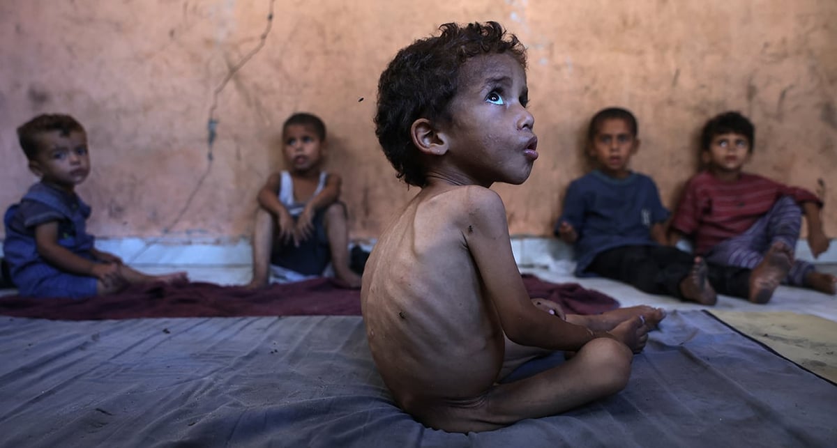 À Gaza, les pénuries de denrées alimentaires impactent et handicapent une grande partie de la population.