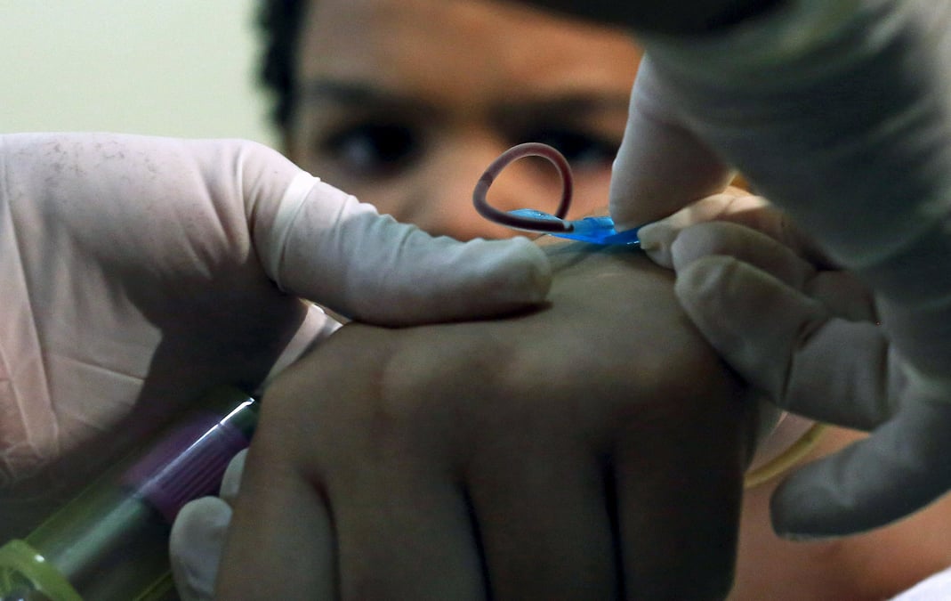 Le virus zika pourrait etre lie a la hausse des cas de microcephalies au bresil