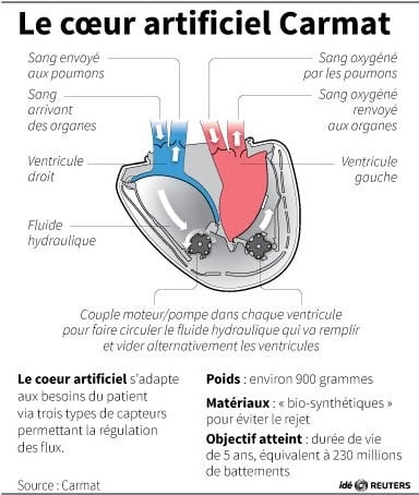 Carmat chute en Bourse après le décès du patient