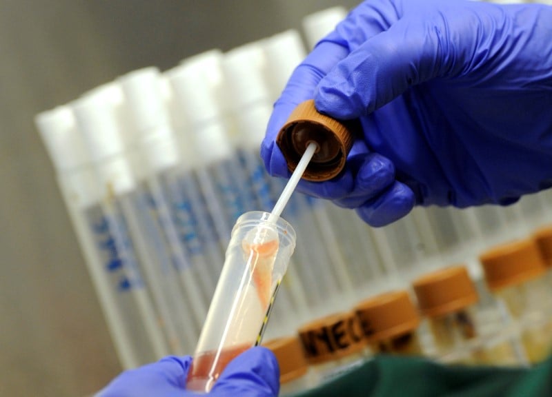 Premier cas de bacterie ultraresistante signale aux usa