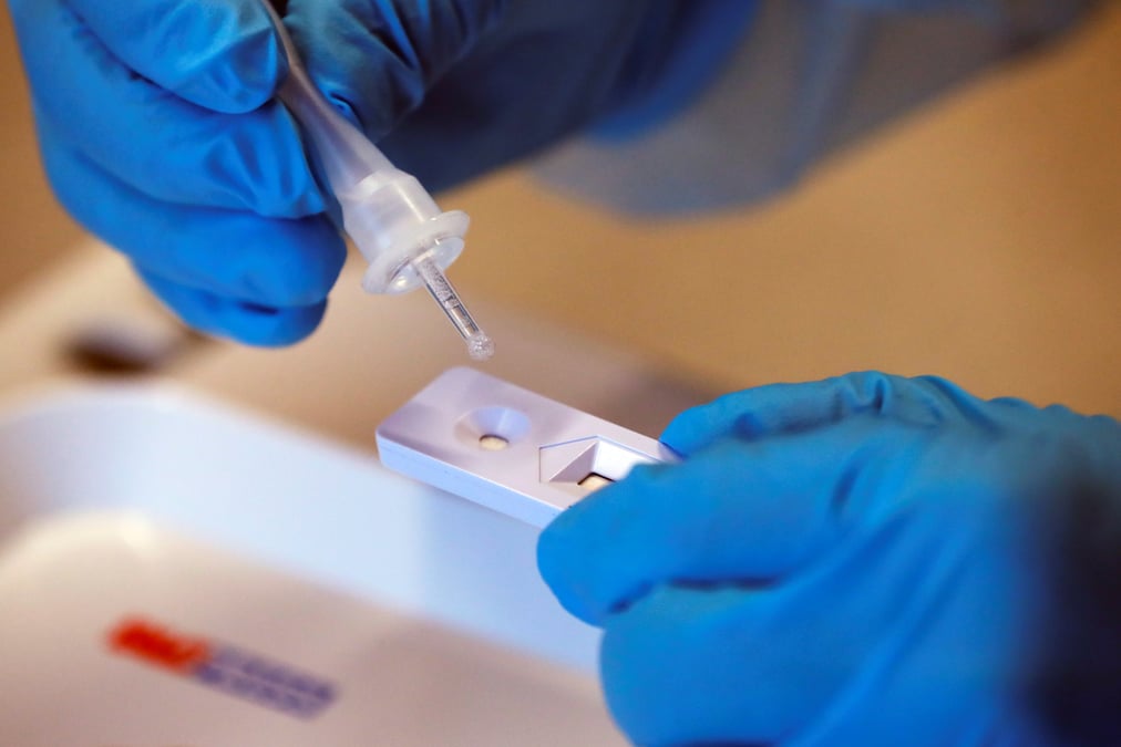 Coronavirus: l'allemagne recense 31.300 cas supplementaires