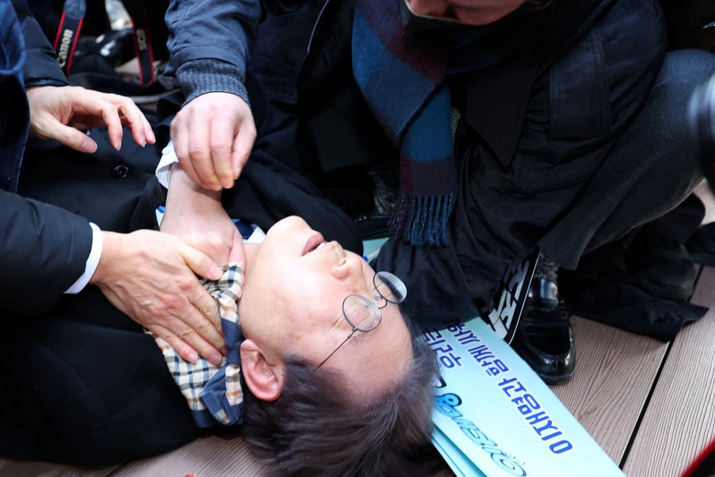 Le chef du parti d'opposition sud-coreen lee jae-myung apres avoir ete attaque par un homme lors de sa visite a busan