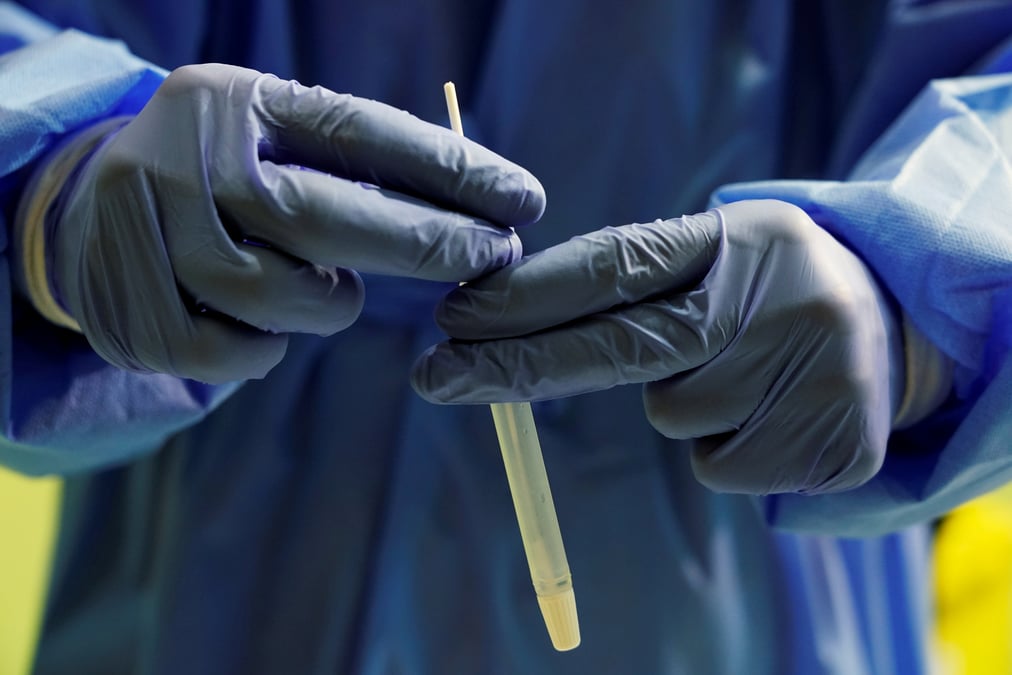 Coronavirus: l'espagne signale 11.078 nouveaux cas en 24 heures