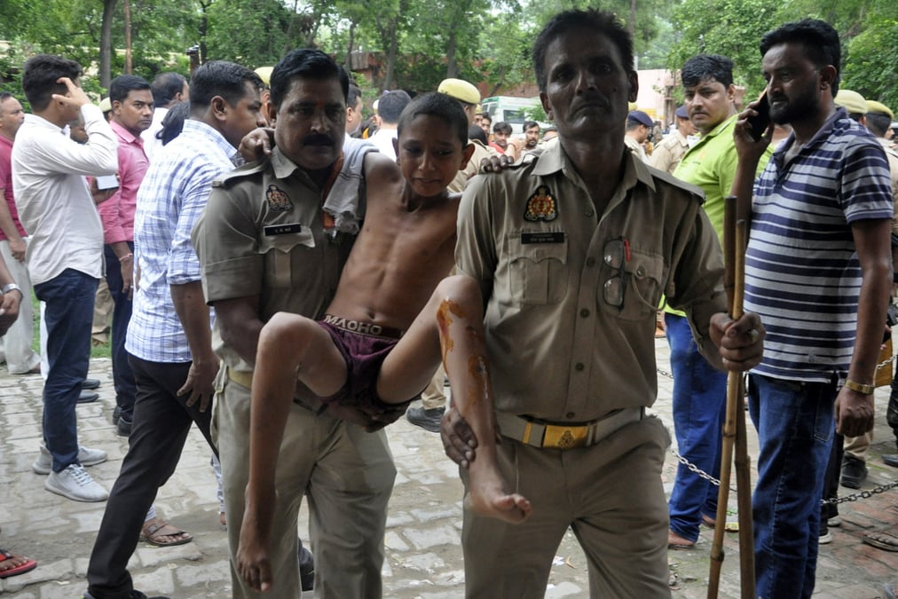 Un garcon, blesse au cours d'une bousculade lors d'un rassemblement religieux en inde.