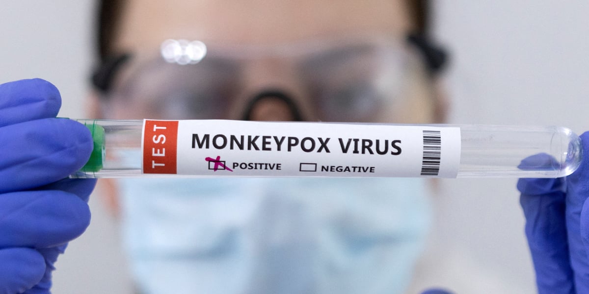 Le mpox se manifeste principalement par une forte fièvre et l'apparition de lésions cutanées, dites vésicules.