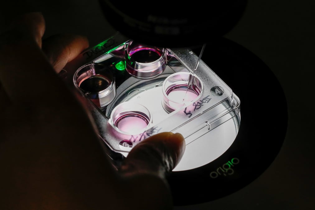 Biomerieux chute en bourse, deception sur l'operationnel et les previsions