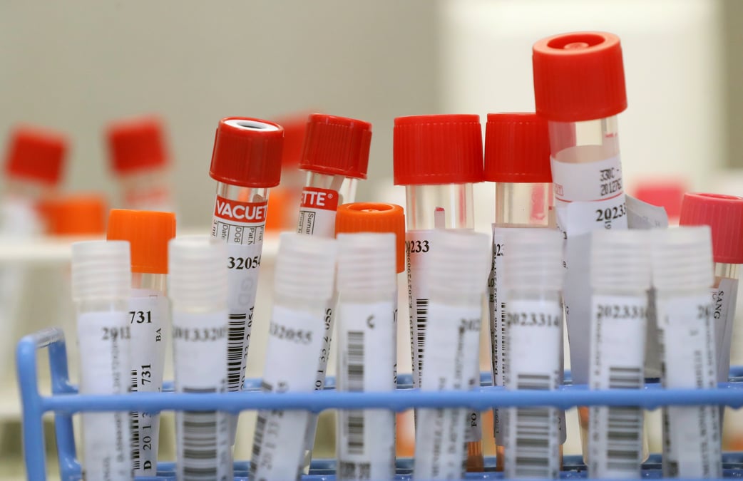 Coronavirus: des cas de reinfection en belgique et aux pays-bas, selon la presse