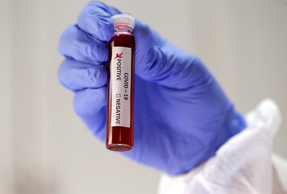 Coronavirus: 115 morts de plus aux pays-bas