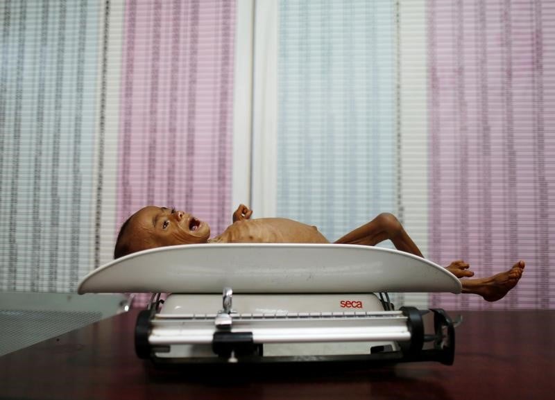 Pour la premiere fois en 10 ans, la faim progresse dans le monde