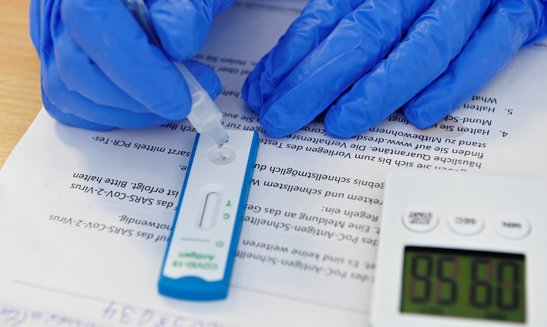 Coronavirus: plus de 9.000 nouveaux cas enregistres en allemagne