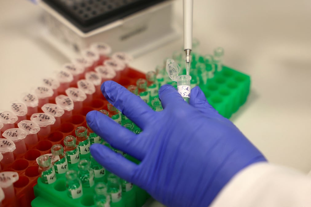 Trois syndicats de biologistes médicaux ont annoncé qu'ils « lèvent leur consigne de "shutdown" (fermeture, ndlr) des laboratoires pour cette fin d'année ».